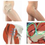 Η προσπέλαση στην AMIS