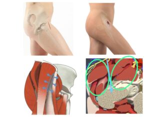 Η προσπέλαση στην AMIS