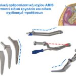 AMIS και ειδικά εργαλεία