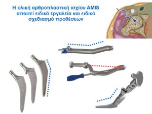 AMIS και ειδικά εργαλεία