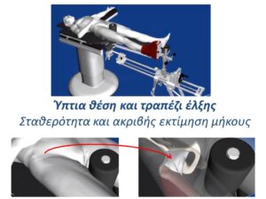 Ειδικό τραπέζι έλξης AMIS