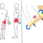 Πόνος οστεαρθρίτιδας ισχιου