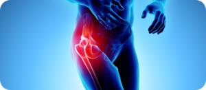 Παθήσεις ισχύου