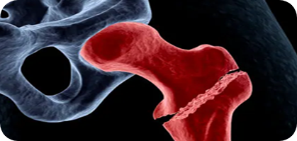 Καταγματα Ισχύου